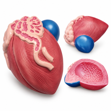 Male-Bladder-and-Prostate-Anatomy-Model-Median-Section